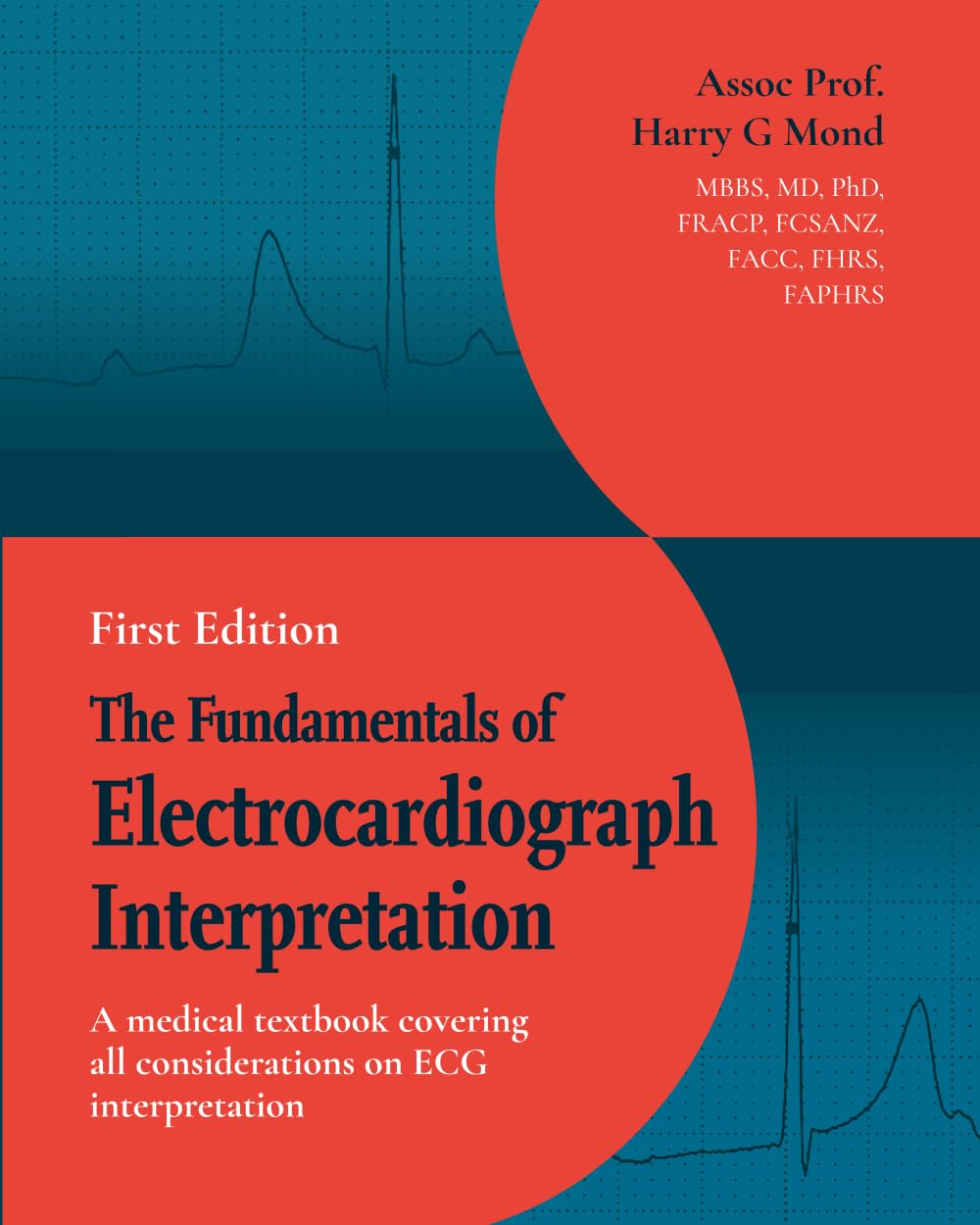 The Fundamentals of Electrocardiograph Interpretation Medicine