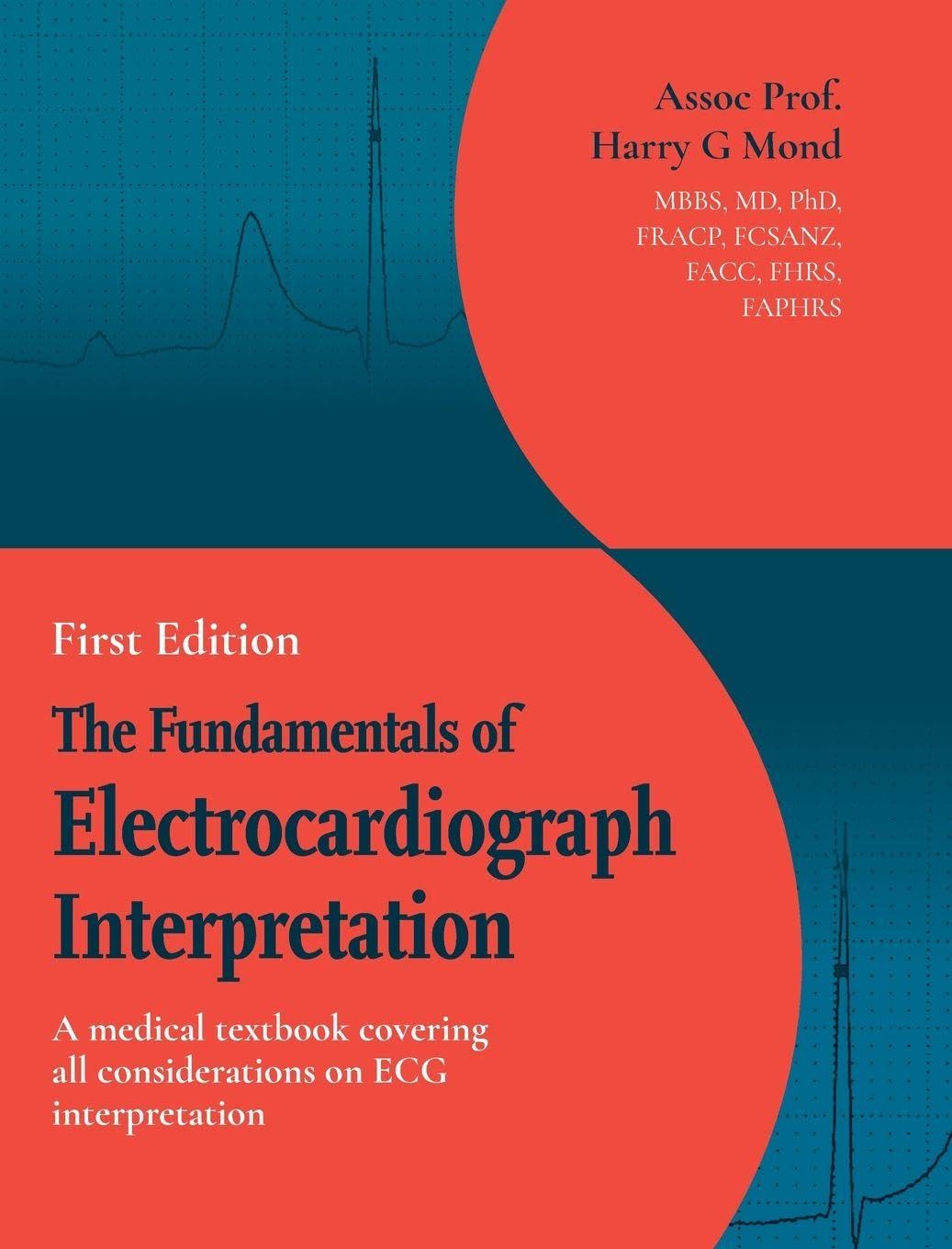 The Fundamentals of Electrocardiograph Interpretation Medicine