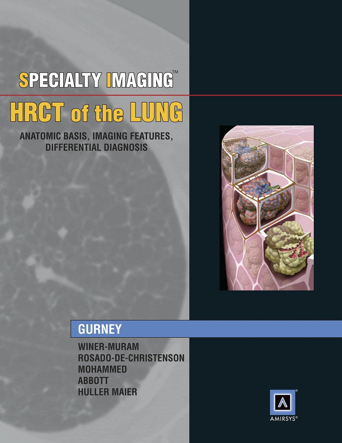 HRCT of the Lung: Anatomic Basis, Imaging Features, Differential Diagnosis. Includes Amirsys Online Acces Medicine