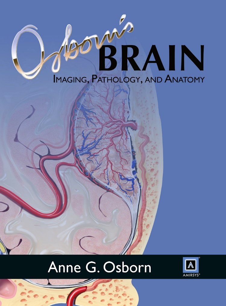 Osborns Brain: Imaging, Pathology, and Anatomy Medicine