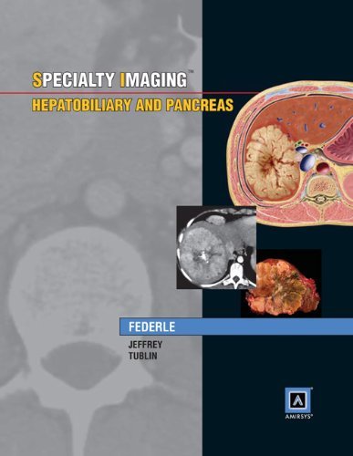 Specialty Imaging: Hepatobiliary and Pancreas Medicine