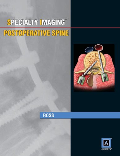 Postoperative Spine Medicine Books
