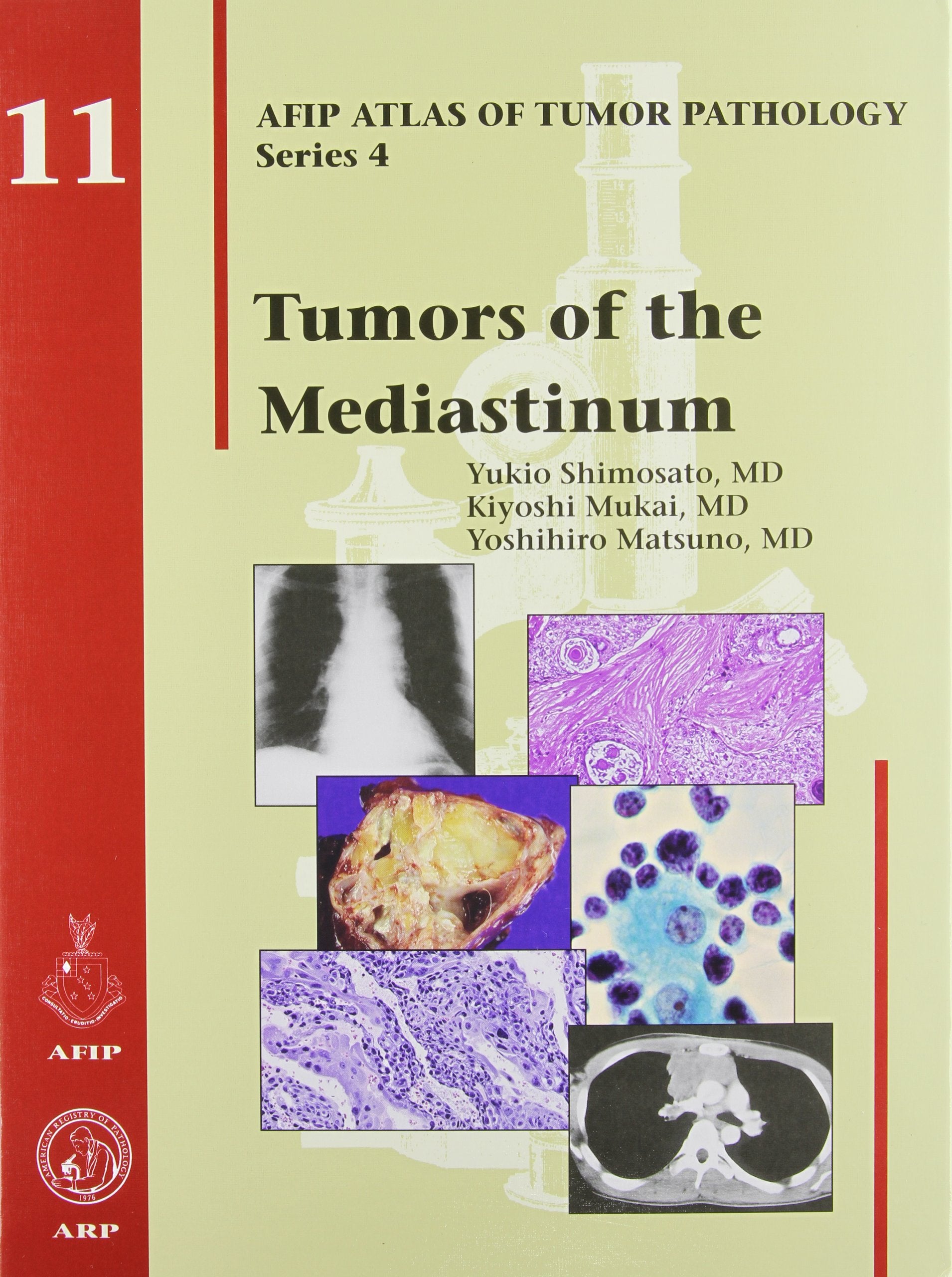 TUMORS OF THE MEDIASTINUM (AFIP Atlas of Tumor Pathology, Series 4,) Medicine