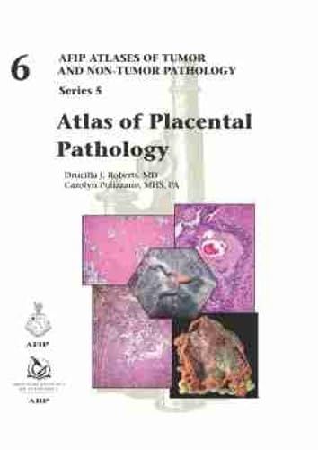 Atlas of Placental Pathology (AFIP Atlas of Tumor and Non-Tumor Pathology, Series 5, Band 6) Medicine