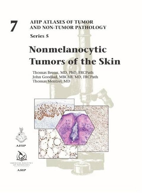 Nonmelanocytic Tumors of the Skin: 7 (AFIP Atlas of Tumor and Non-Tumor Pathology, Series 5) book