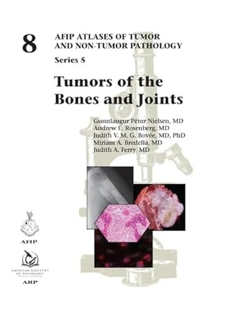Tumors of the Bones and Joints (AFIP Atlases of Tumor and Non-tumor Pathology, Series 5, Band 8) Medicine