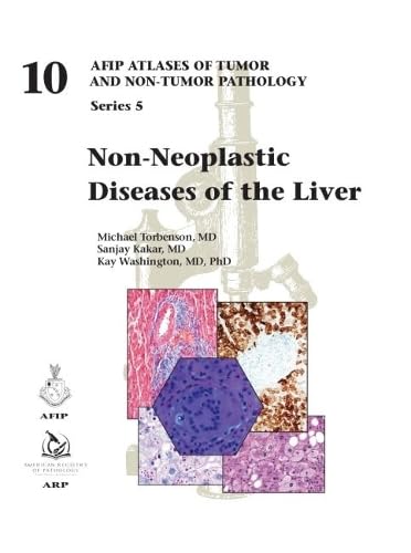 Non-Neoplastic Diseases of the Liver (AFIP Atlas of Tumor and Non-Tumor Pathology, Series 5, Band 10) Medicine