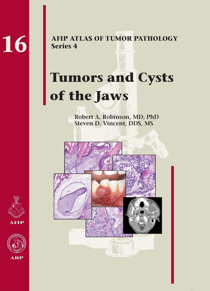 Tumors and Cysts of the Jaws book