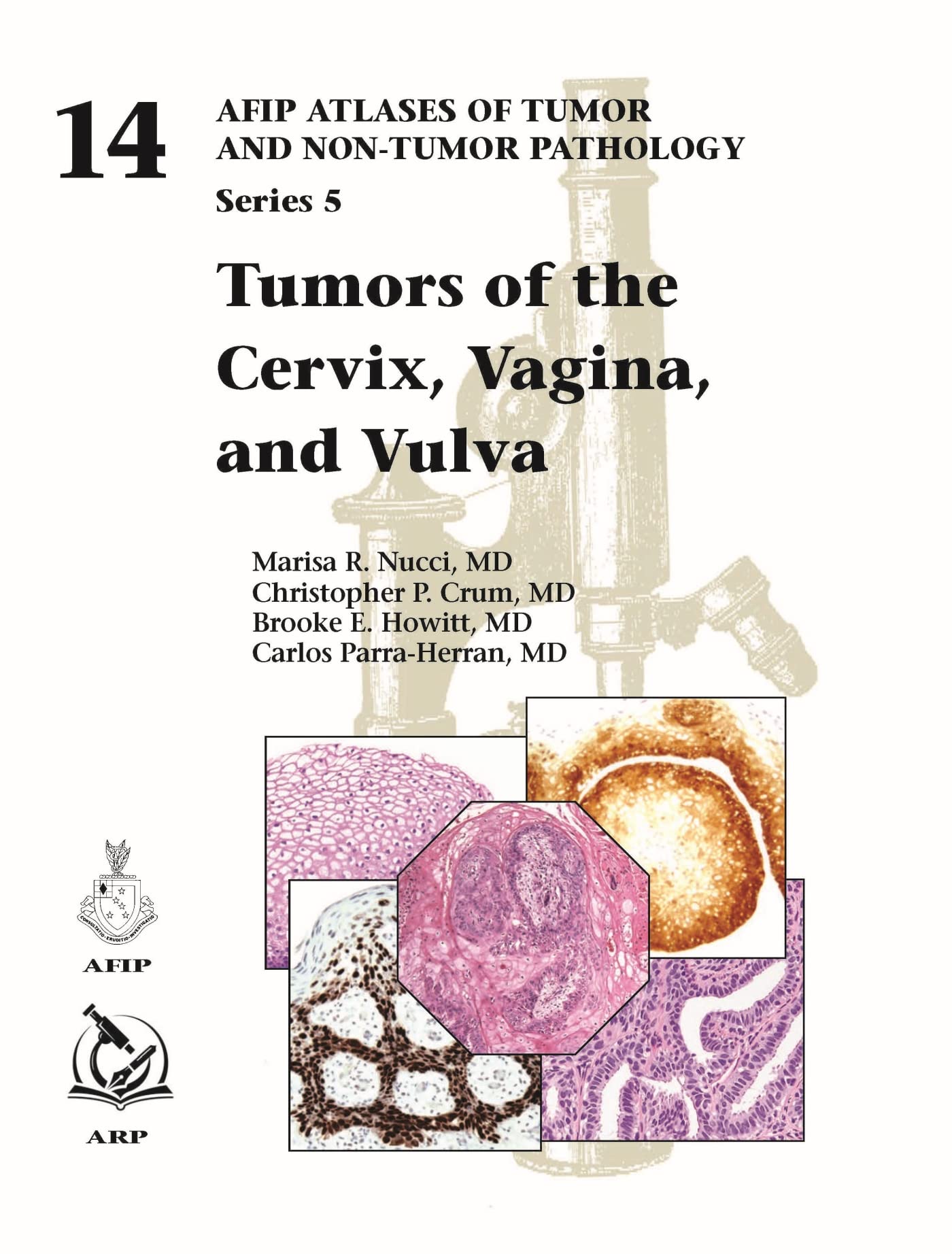 Tumors of the Cervix, Vagina, and Vulva (AFIP Atlas of Tumor and Non-Tumor Pathology, Series 5, Band 14) Medicine