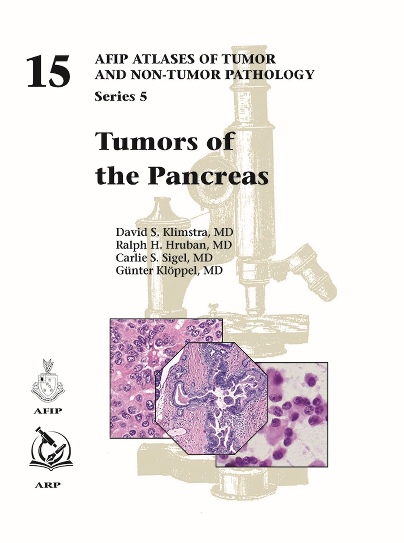 Tumors of the Pancreas (AFIP Atlas of Tumor and Non-Tumor Pathology, Series 5, Band 15) Medicine