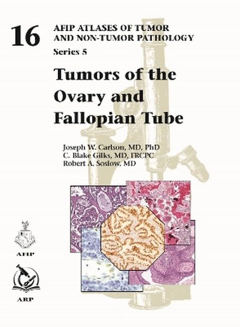 Tumors of the Ovary and Fallopian Tube (AFIP Atlas of Tumor and Non-Tumor Pathology, Series 5) Medicine