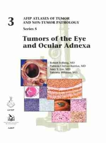 Tumors of the Eye and Ocular Adnexa (AFIP Atlas of Tumor and Non-Tumor Pathology, Series 5, Band 3) Medicine