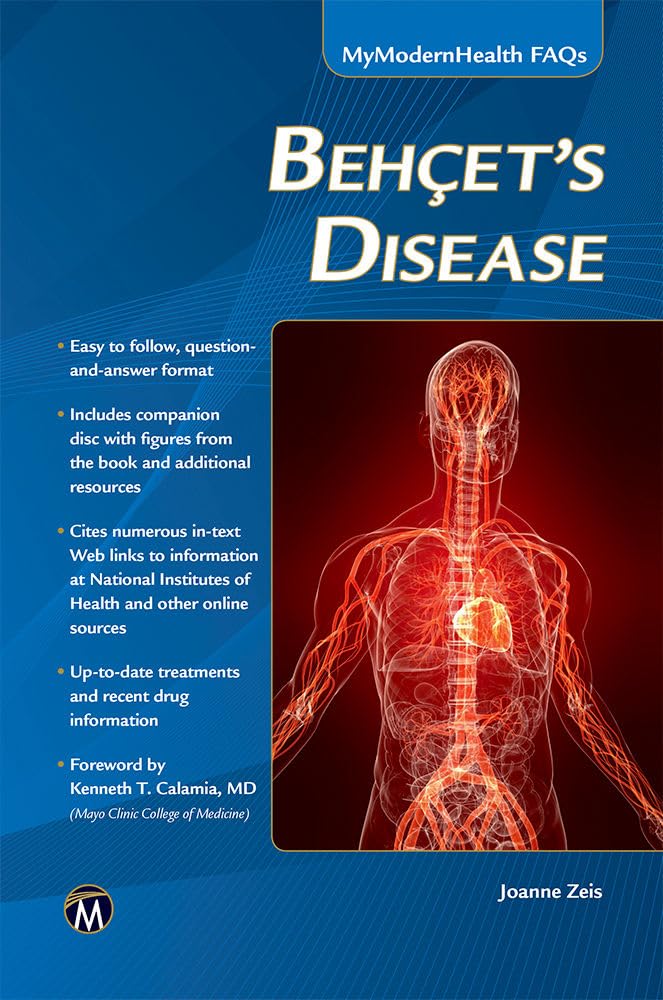 Behcet’s Disease (MyModernHealth FAQs) Medicine
