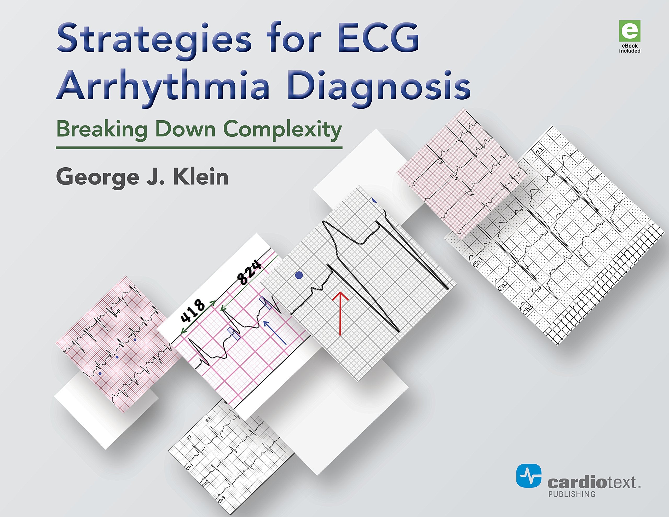 Strategies for ECG Arrhythmia Diagnosis: Breaking Down Complexity Medicine
