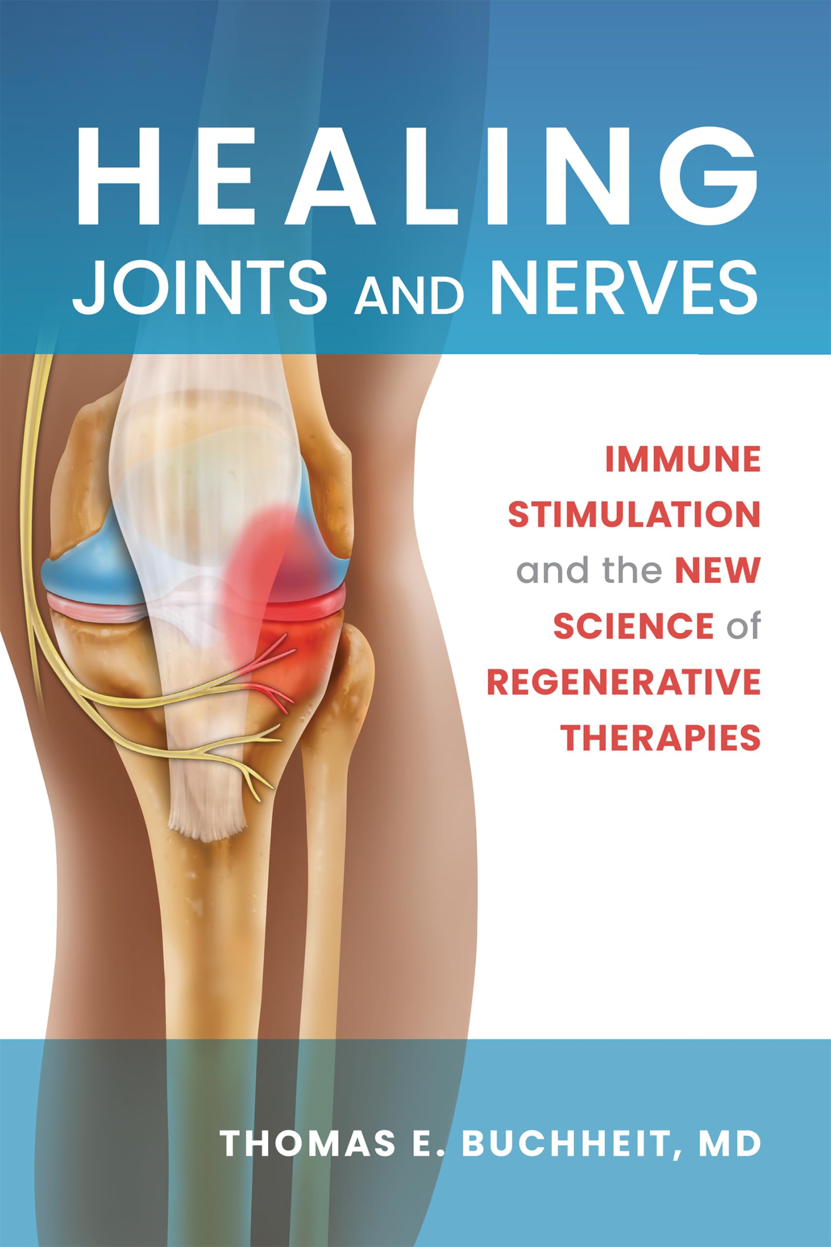 Healing Joints and Nerves: Immune Stimulation and the New Science of Regenerative Therapies Health, Nutrition & Fitness