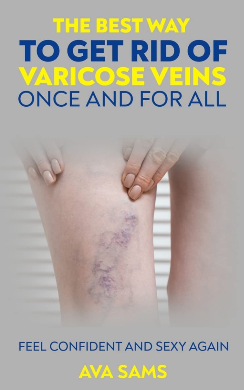 The Best Way to Get Rid of Varicose Veins Once and For All Health, Nutrition & Fitness