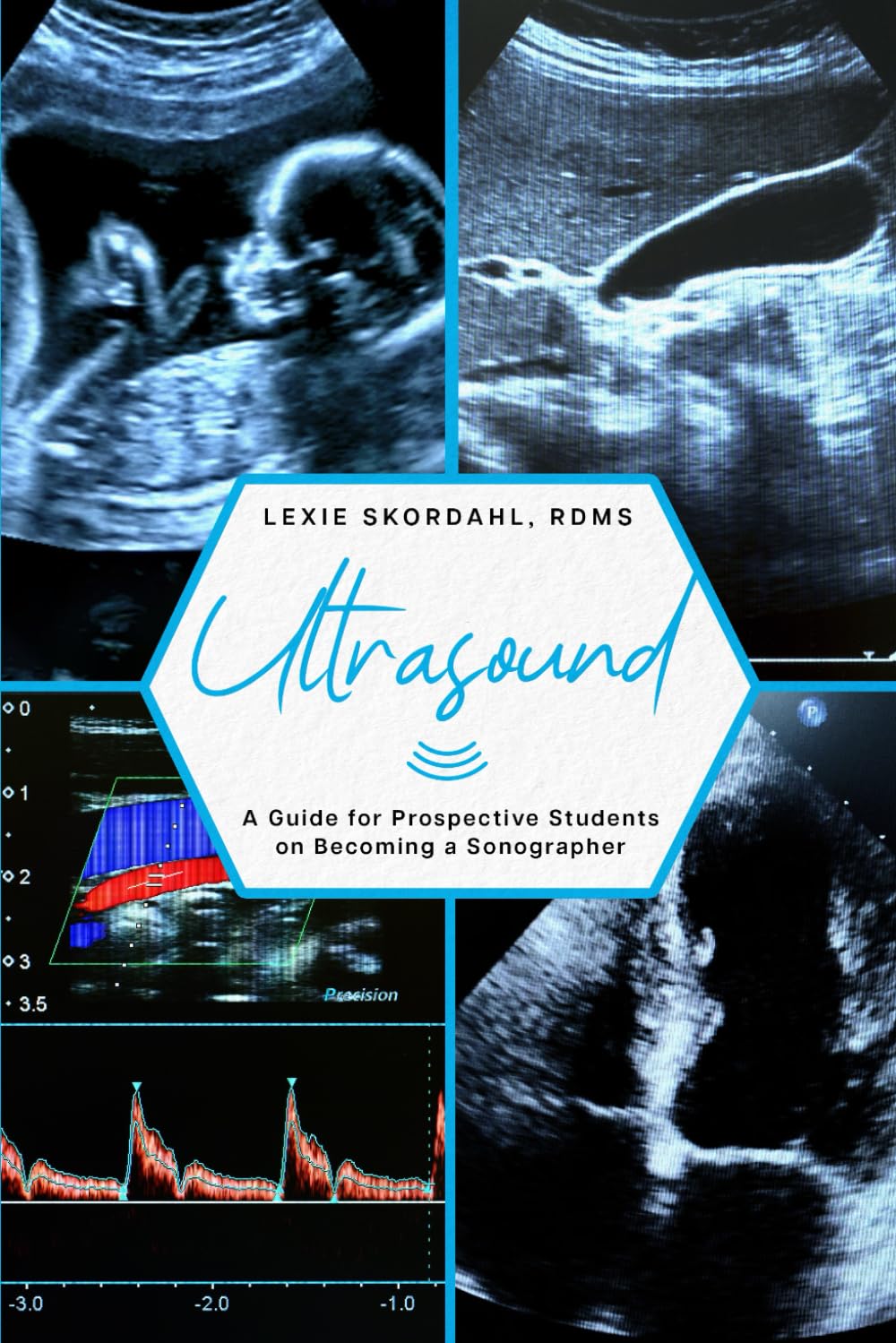 Ultrasound: A Guide for Prospective Students on Becoming a Sonographer Medicine