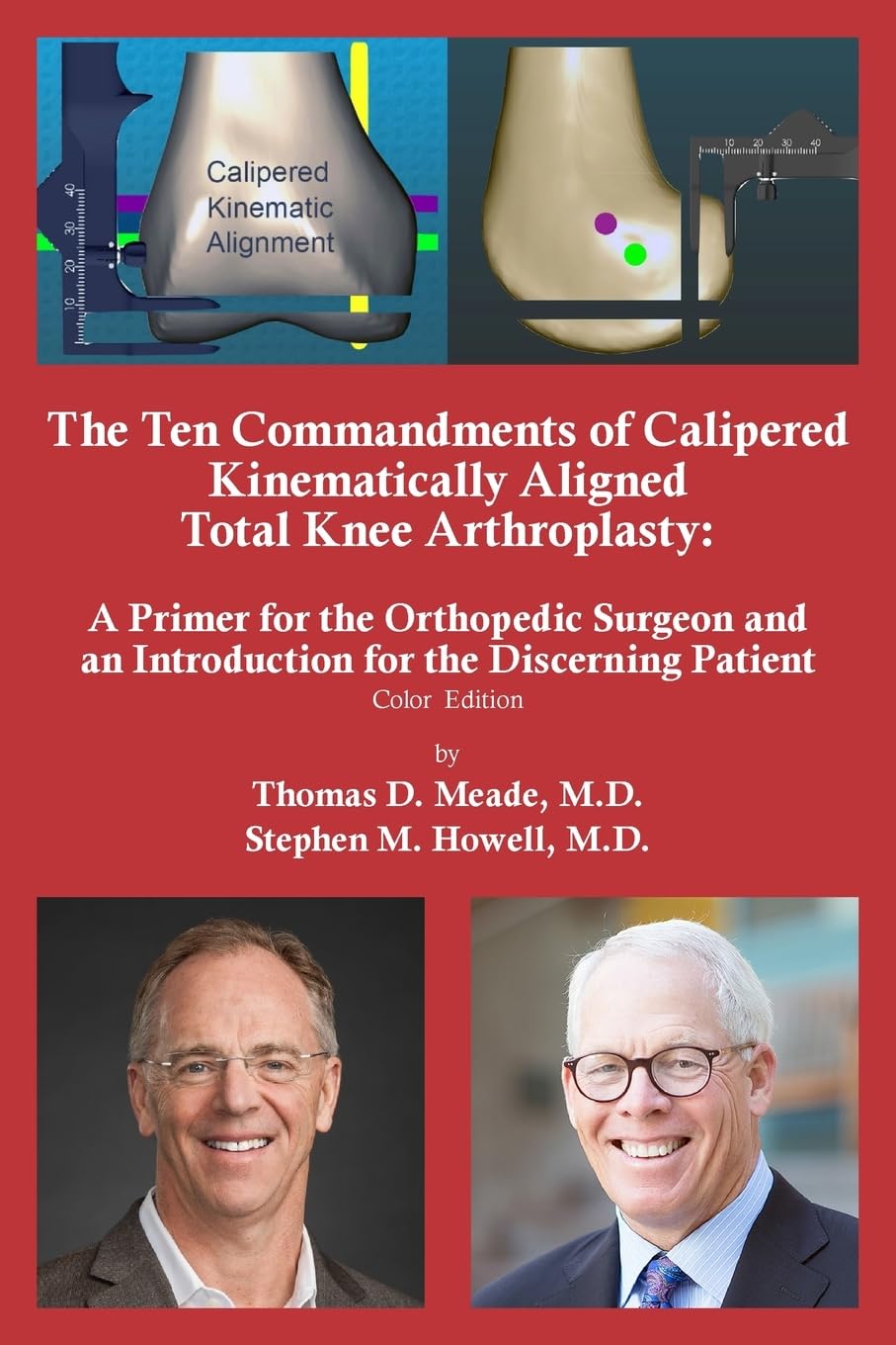 The Ten Commandments of Calipered Kinematically Aligned Total Knee Arthroplasty Medicine