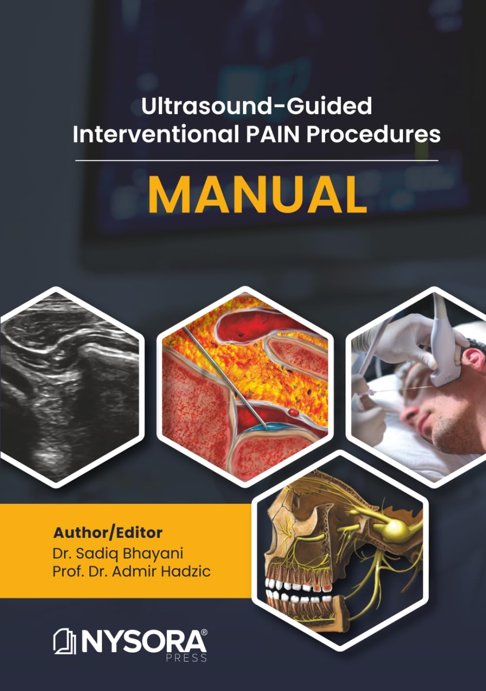 Ultrasound-Guided Interventional Pain Procedures Manual Medicine