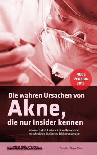 Die wahren Ursachen von Akne, die nur Insider kennen Medicine
