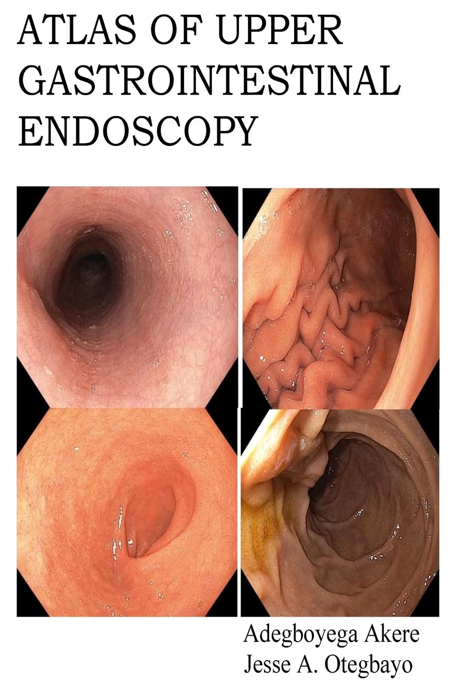 Atlas of Upper Gastrointestinal Endoscopy Medicine