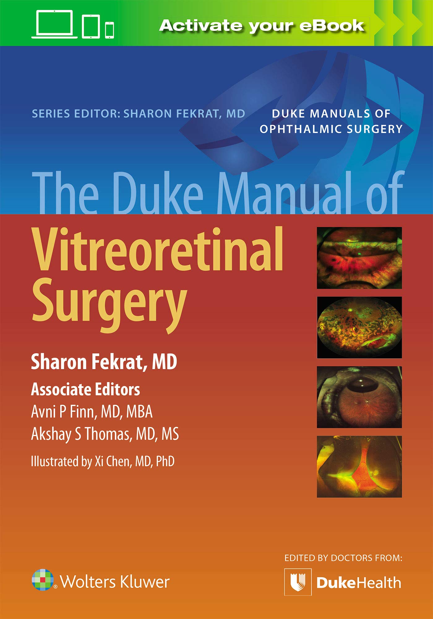 The Duke Manual of Vitreoretinal Surgery Medicine