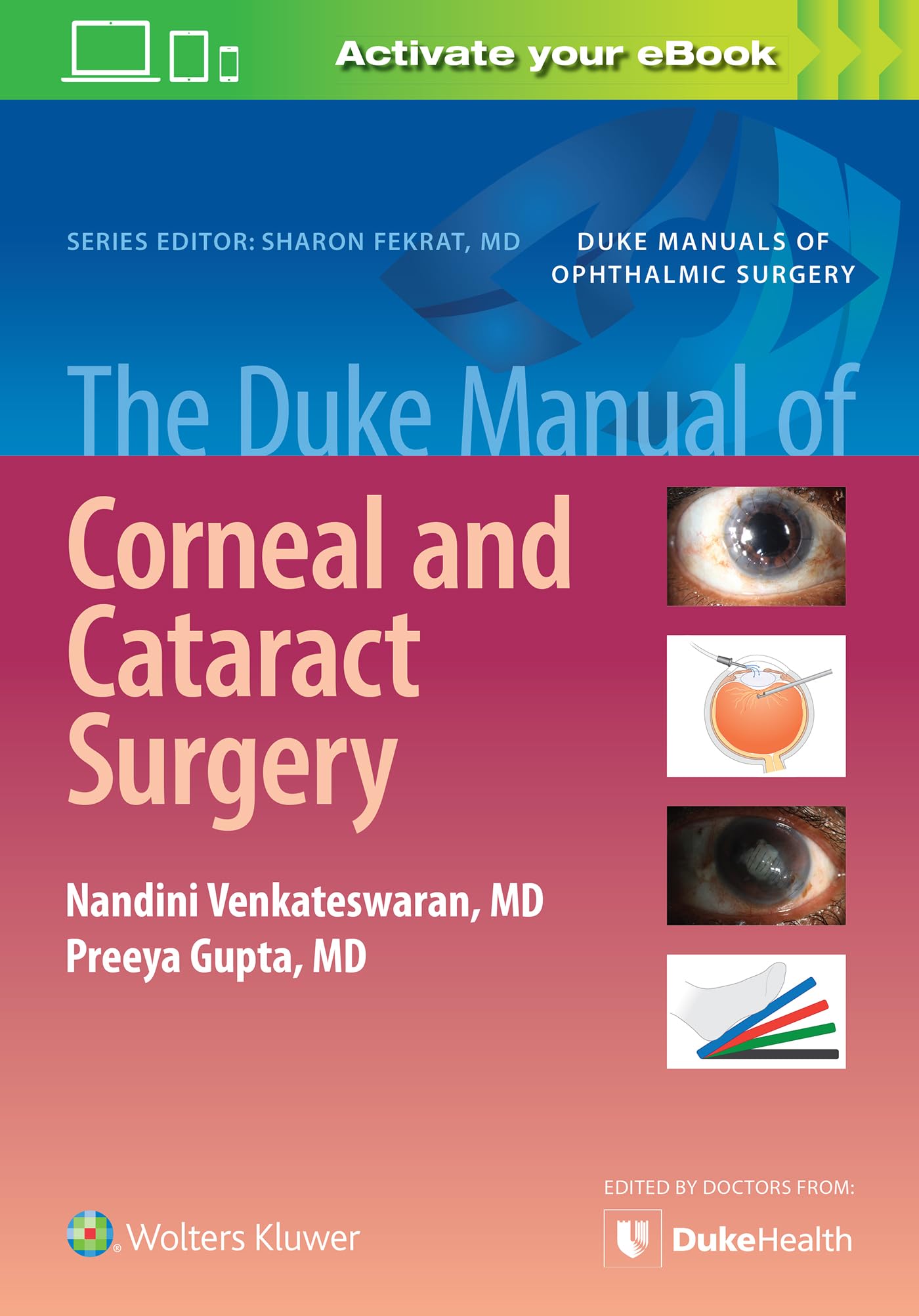 The Duke Manual of Corneal and Cataract Surgery (Duke Manuals of Ophthalmic Surgery) Medicine