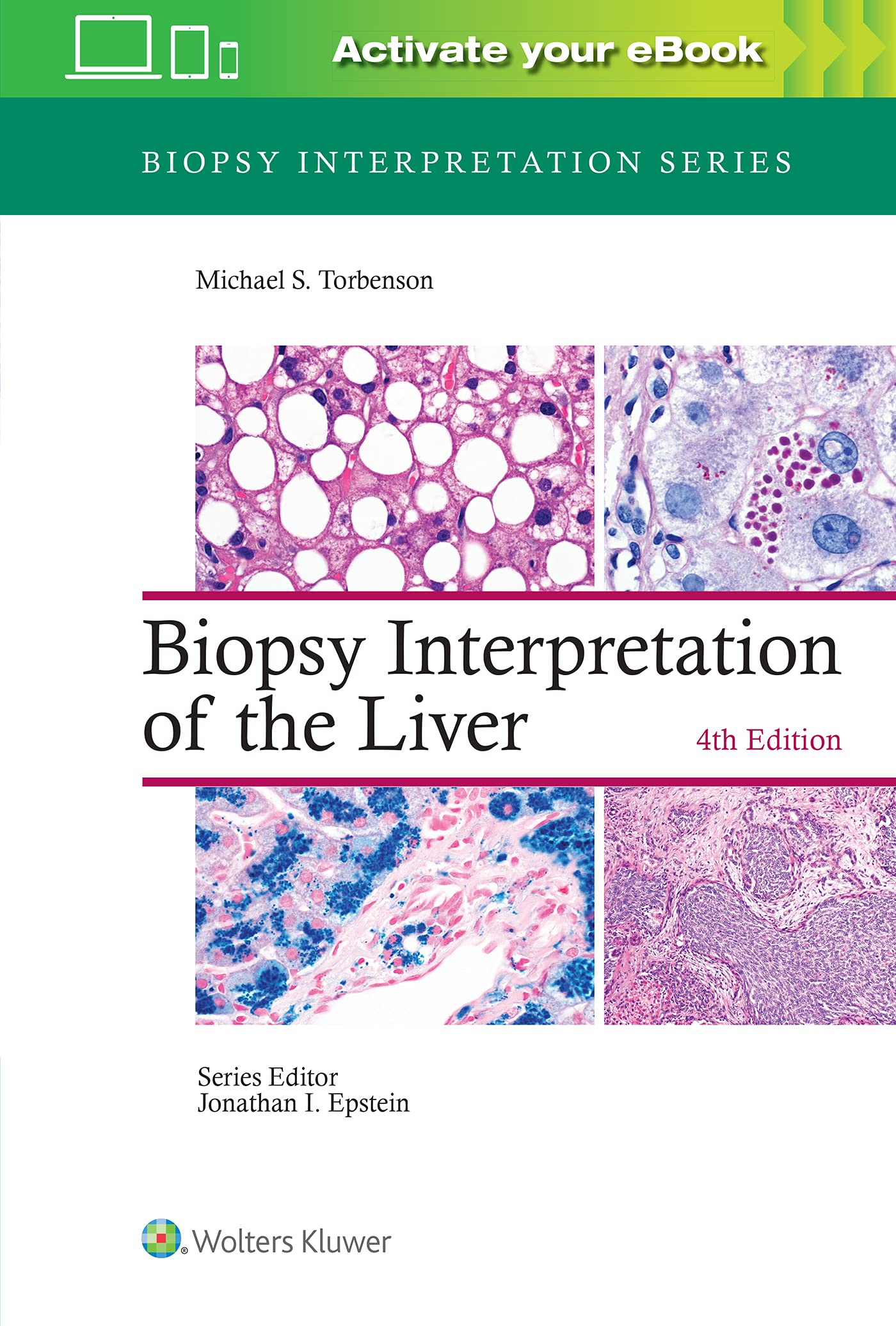 Biopsy Interpretation of the Liver Medicine