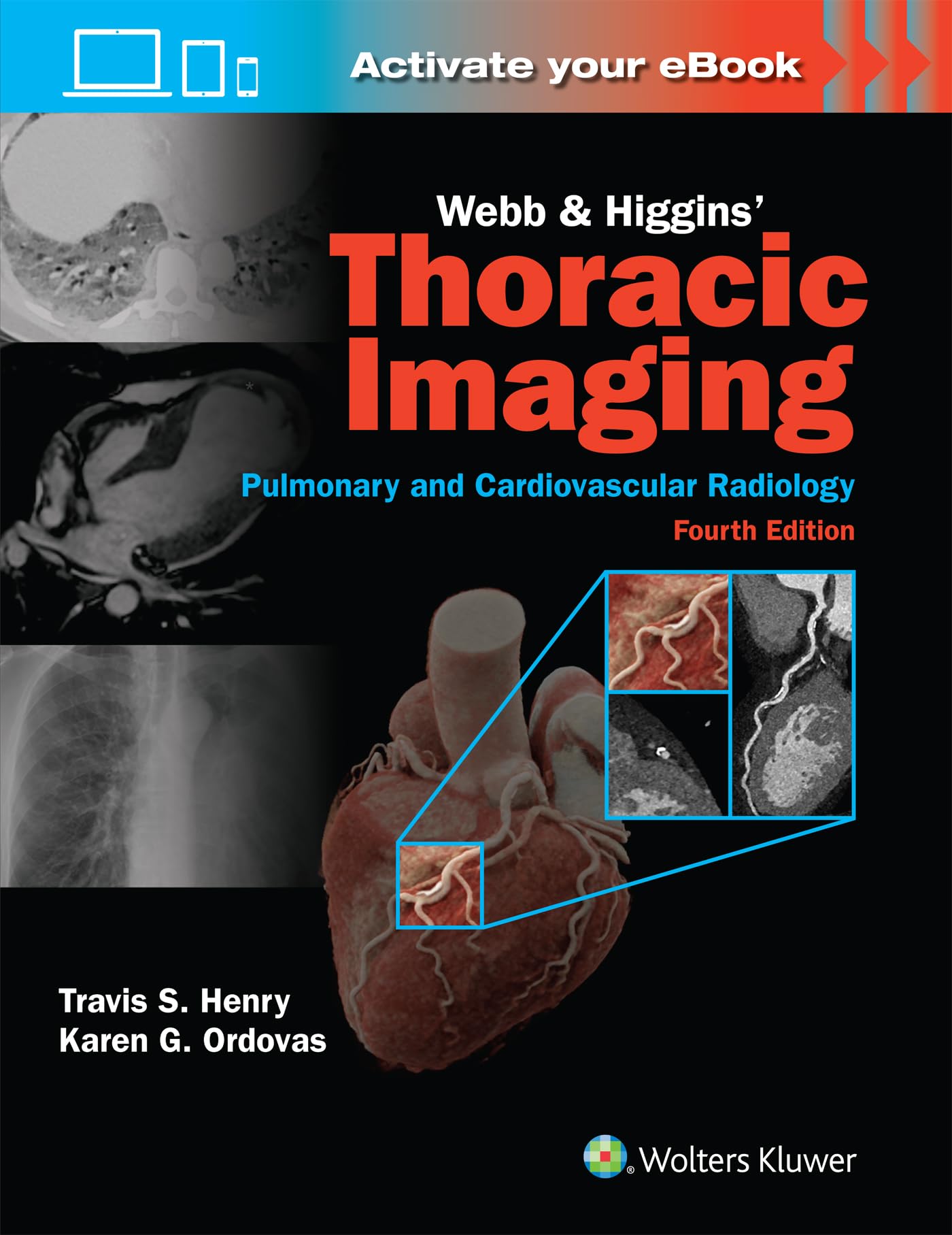 Webb & Higgins Thoracic Imaging: Print + eBook with Multimedia Medicine