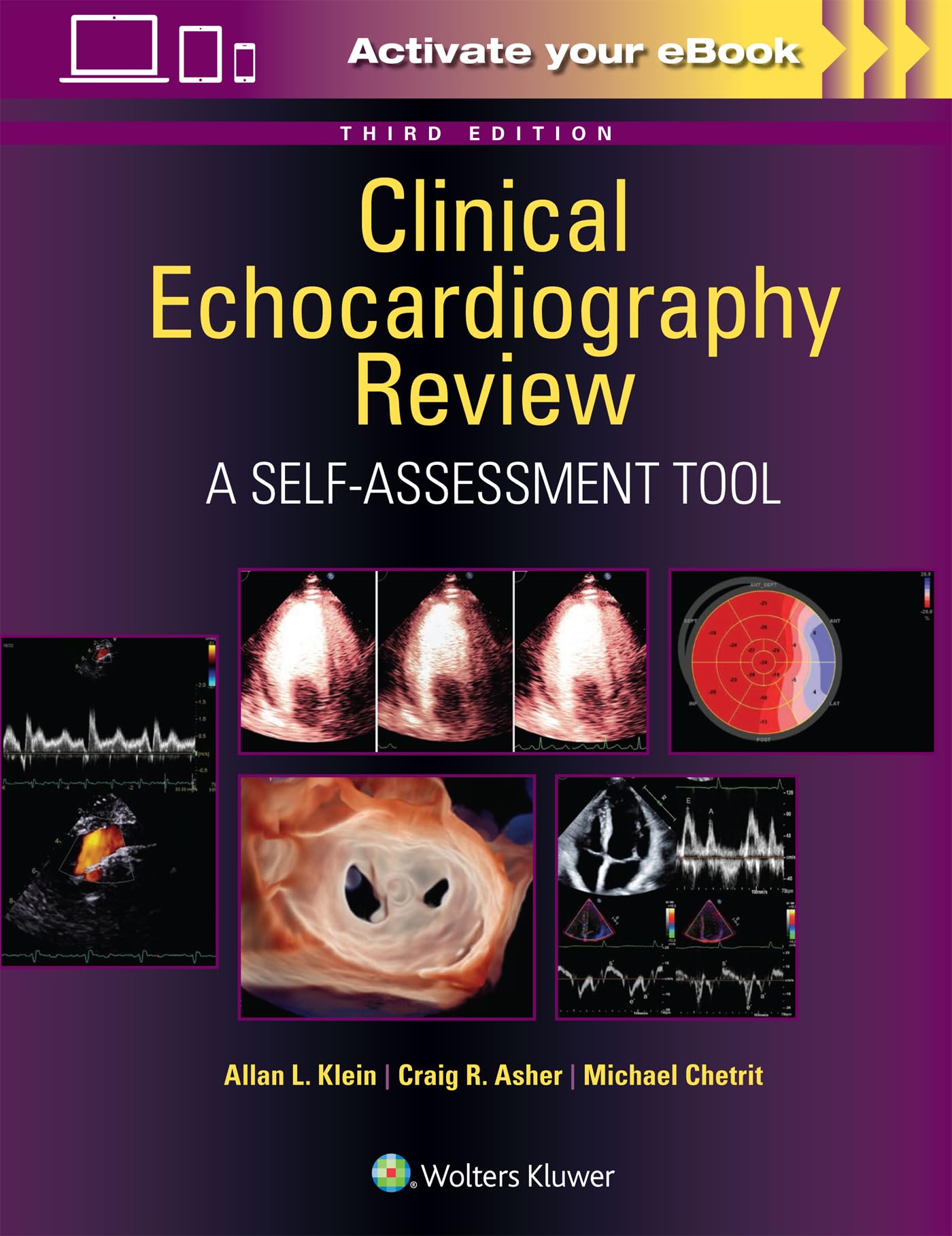 Clinical Echocardiography Review Medicine