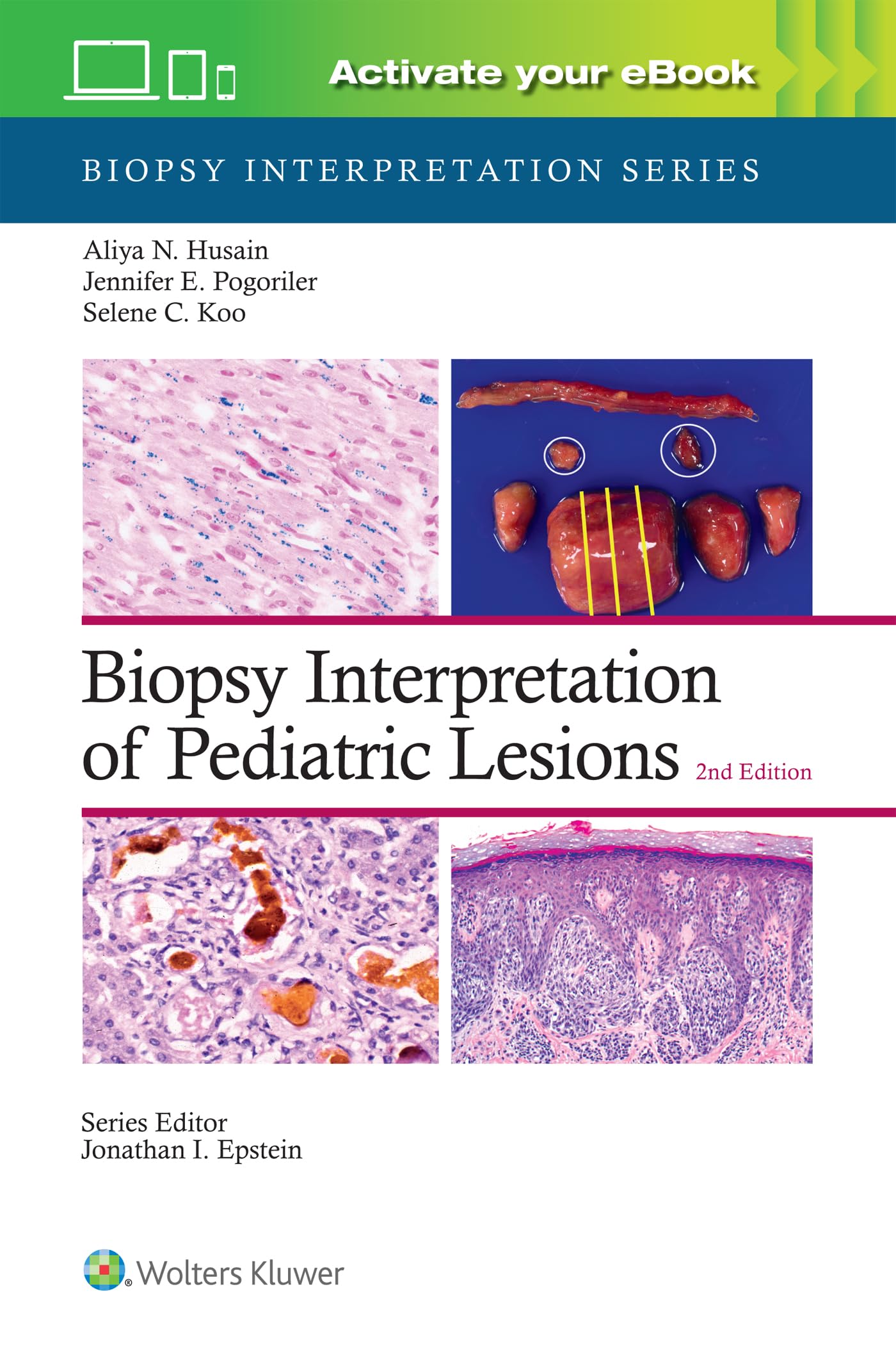 Biopsy Interpretation of Pediatric Lesions: Biopsy Interpretation Series Medicine