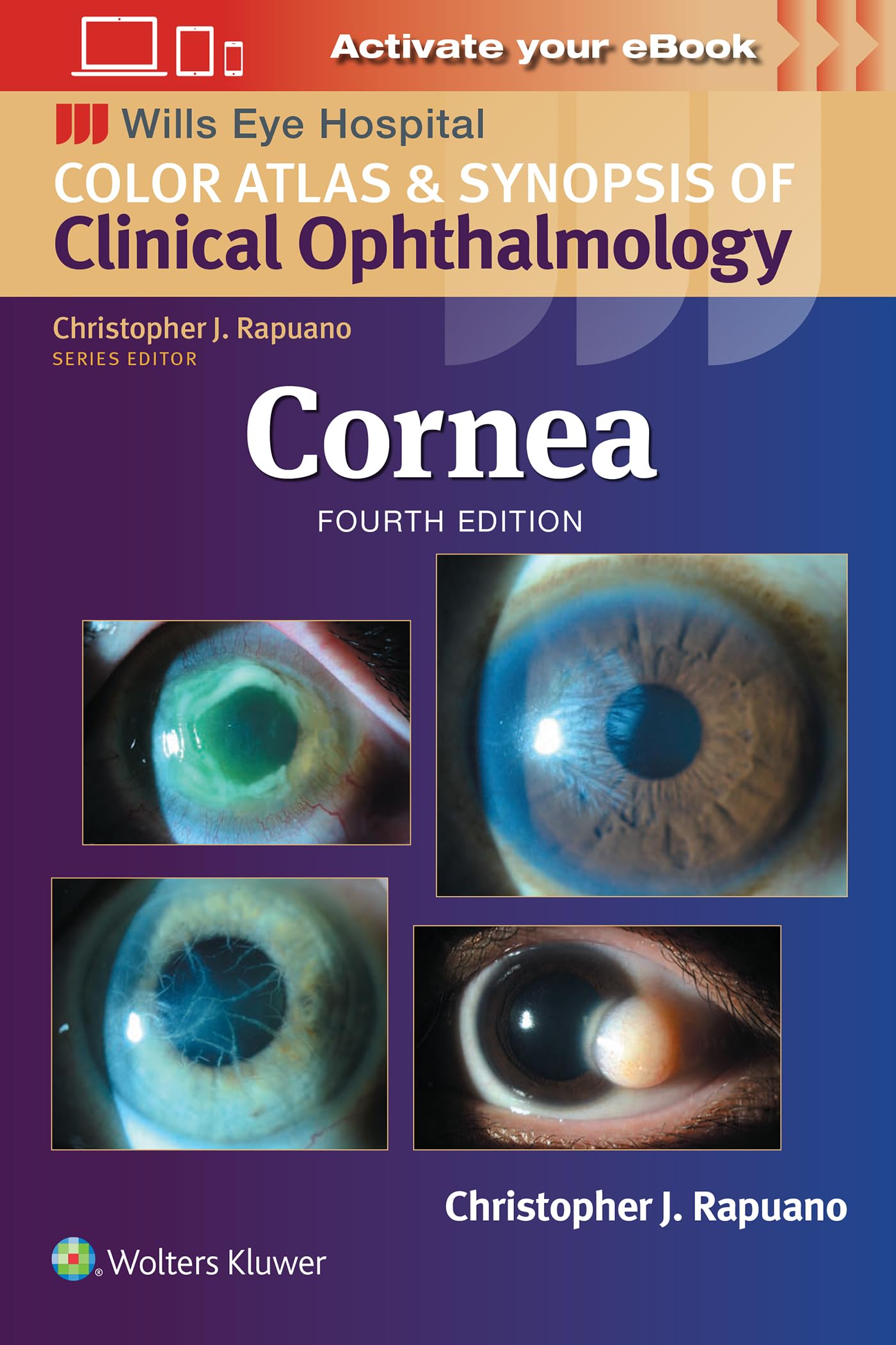 Cornea: Print + eBook with Multimedia (Wills Eye Hospital Color Atlas & Synopsis of Clinical Ophthalmology) Medicine