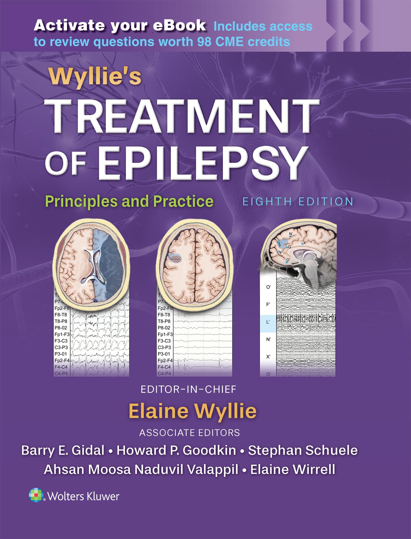 Wyllie's Treatment of Epilepsy: Print + eBook with Multimedia Medicine