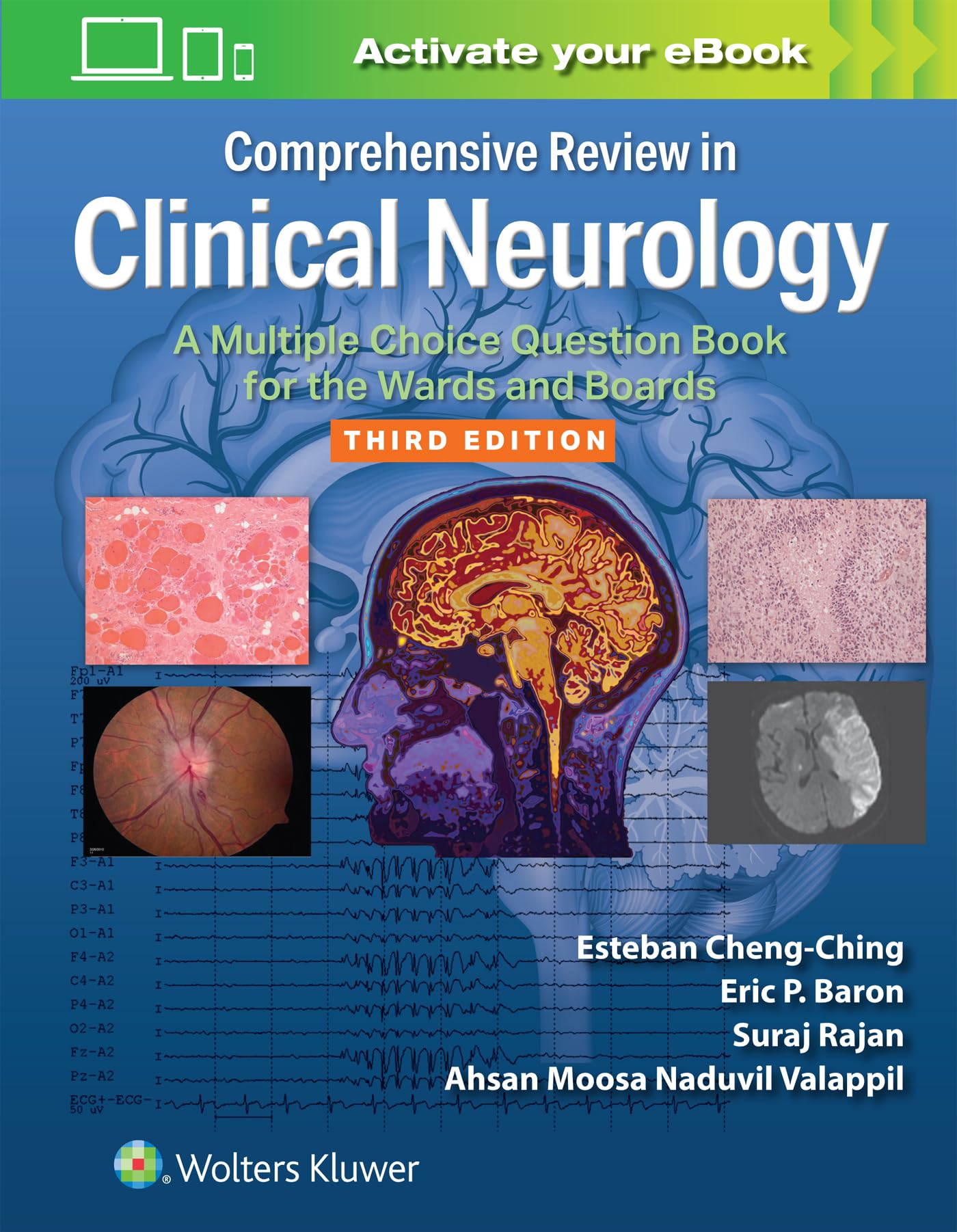 Comprehensive Review in Clinical Neurology Medicine