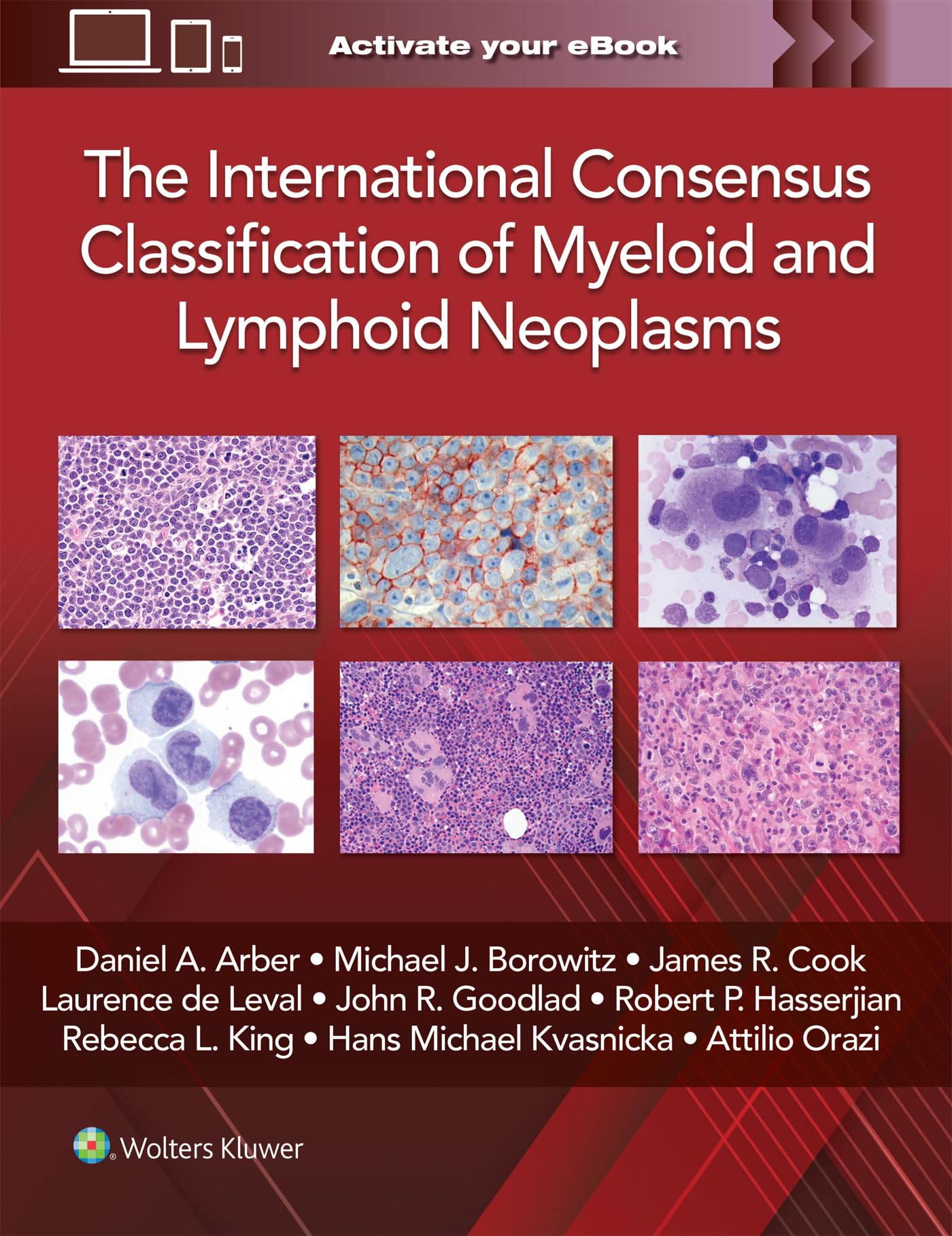 The International Consensus Classification of Myeloid and Lymphoid Neoplasms Medicine