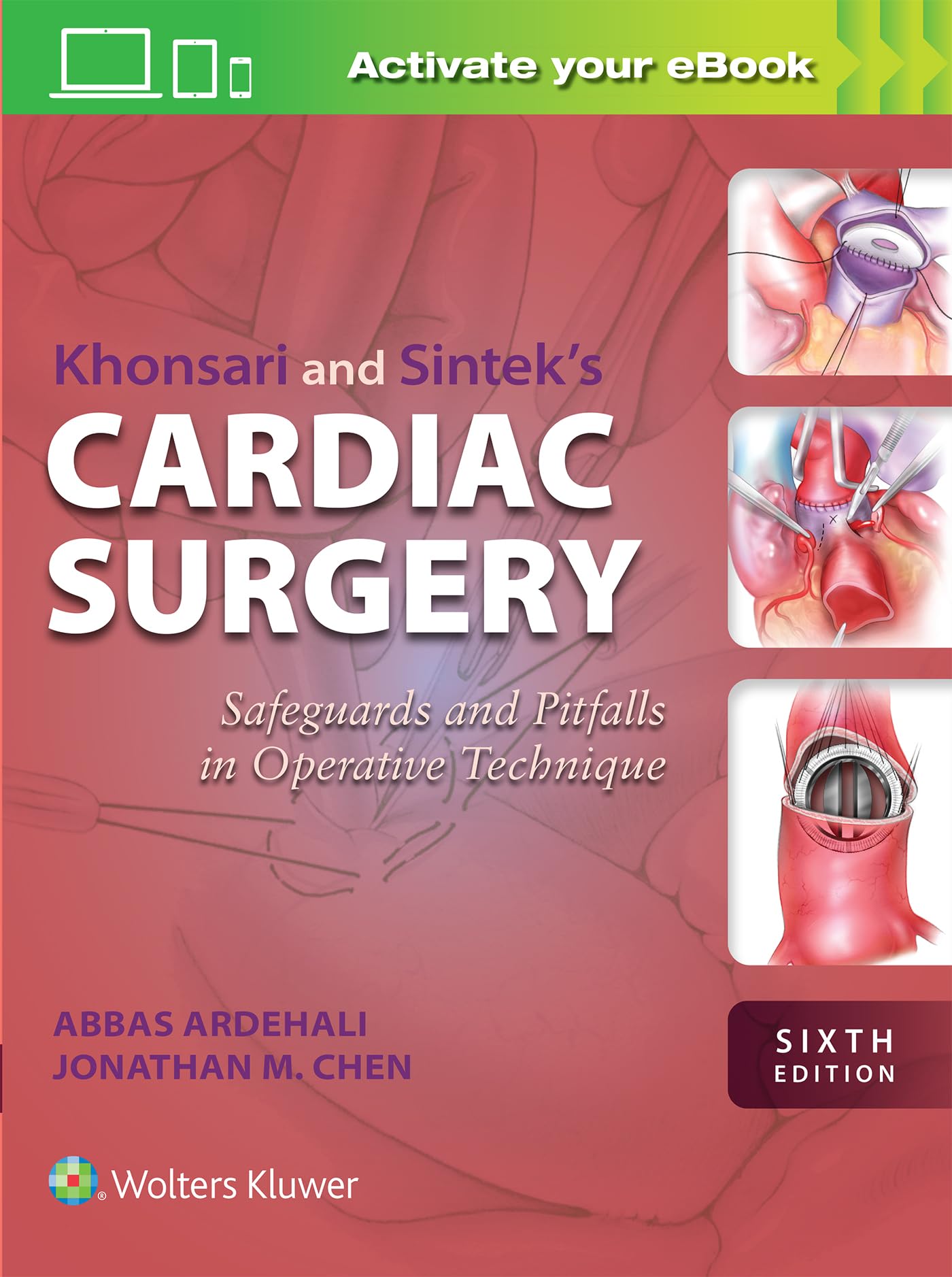 Khonsari and Sintek's Cardiac Surgery Medicine