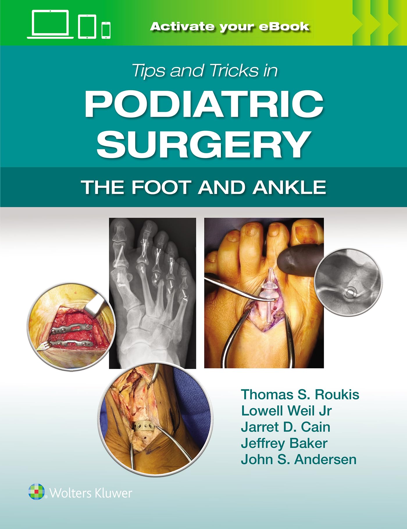 Tips and Tricks in Podiatric Surgery: The Foot and Ankle: Print + eBook with Multimedia Medicine