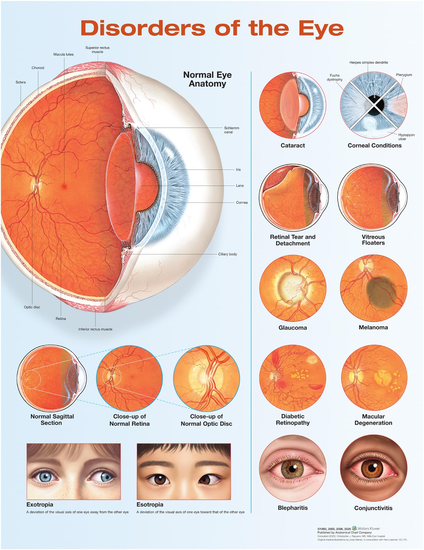 Disorders of the Eye Anatomical Chart Medicine