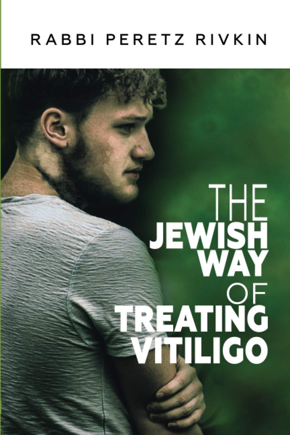 The Jewish Way of Treating Vitiligo Medicine