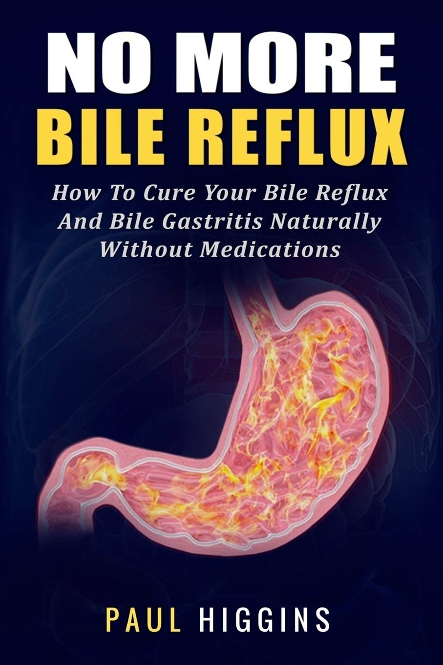 No More Bile Reflux: How to Cure Your Bile Reflux and Bile Gastritis Naturally Without Medications Medicine