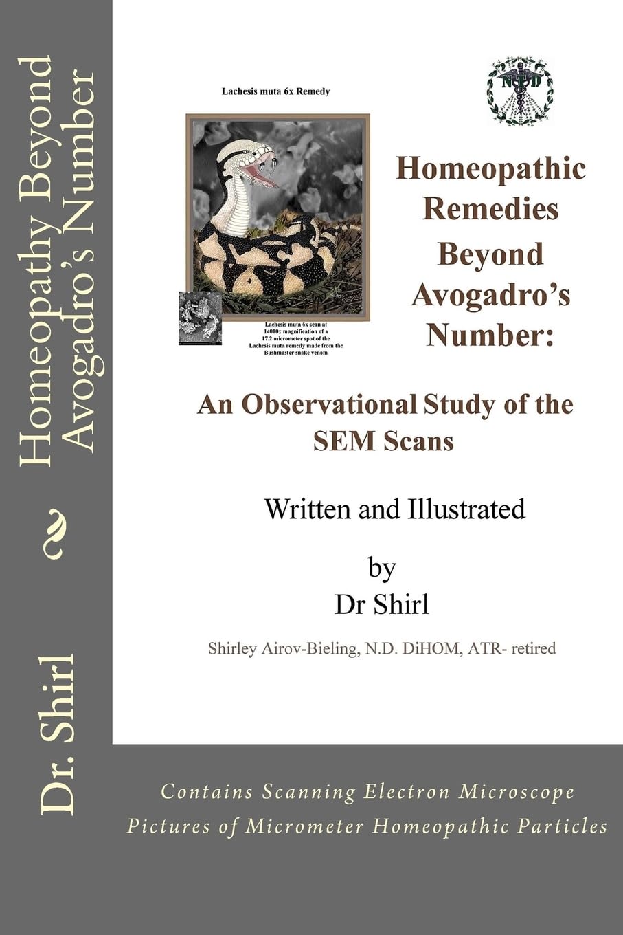 Homeopathy Beyond Avogadro's Number: An Observational Study of the SEM Scans of High Potency Homeopathic Particles Medicine