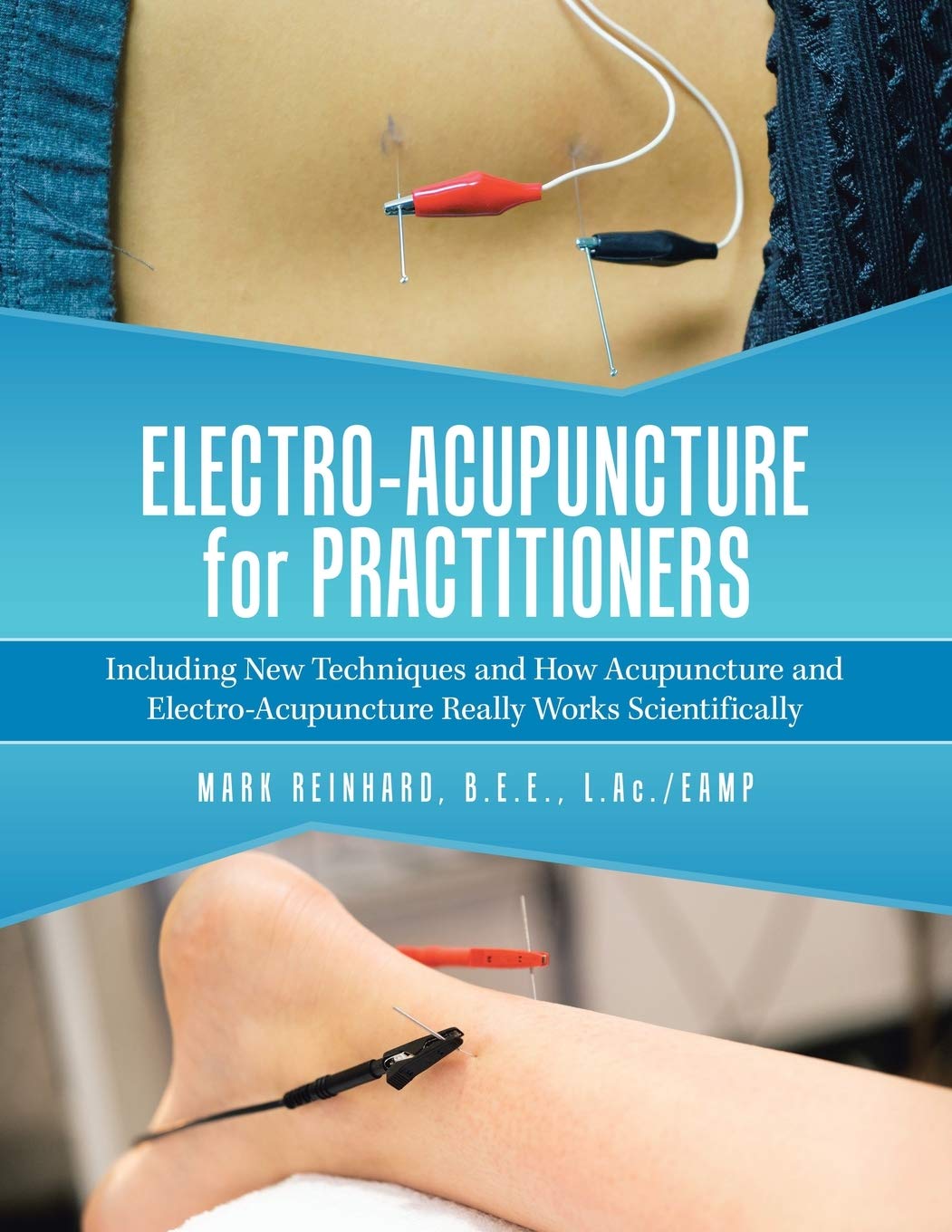 Electro-Acupuncture for Practitioners: Including New Techniques and How Acupuncture and Electro-Acupuncture Really Works Scientifically Learning & Reference