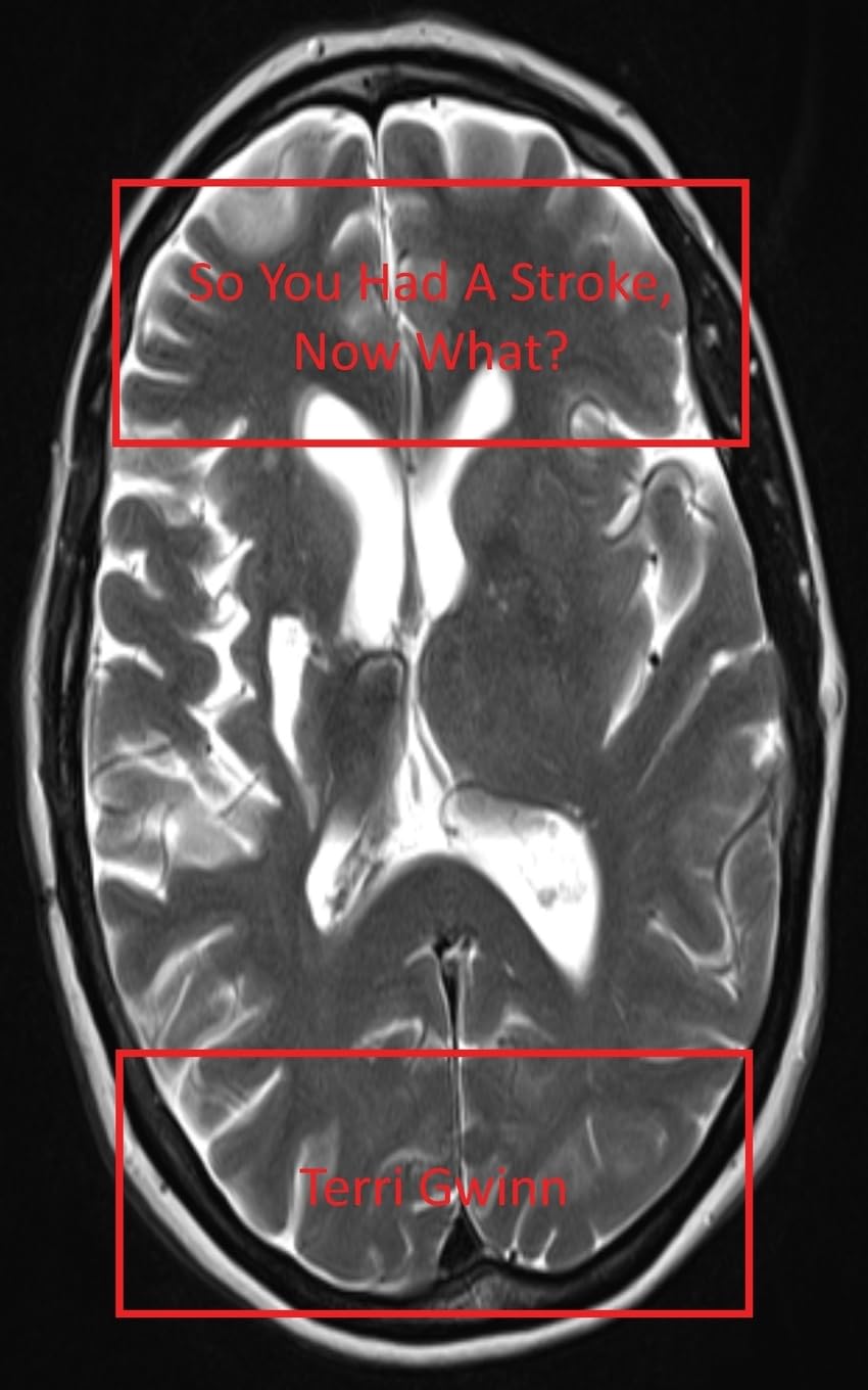 So You Had a Stroke: Now What? Memories