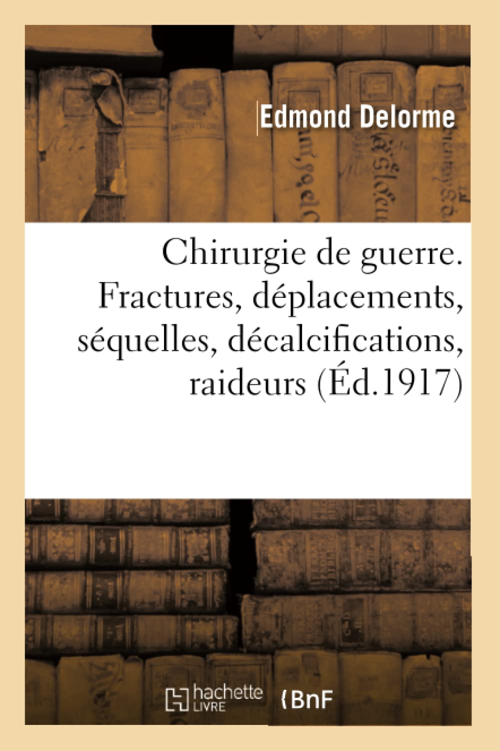 Chirurgie de guerre. Les fractures, déplacements, séquelles, décalcifications book