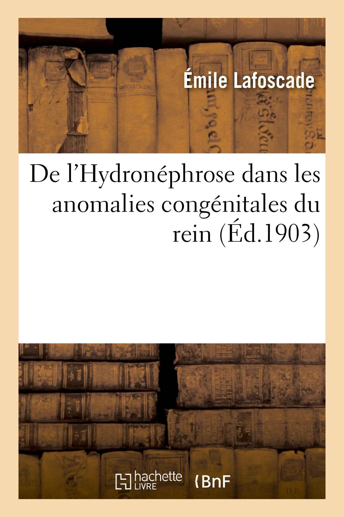 De l'Hydronéphrose dans les anomalies congénitales du rein book