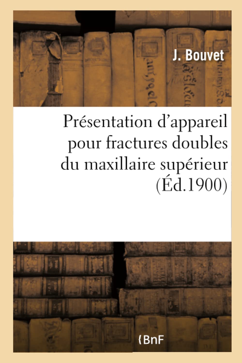 Présentation d'appareil pour fractures doubles du maxillaire supérieur, appareil pour fracture book