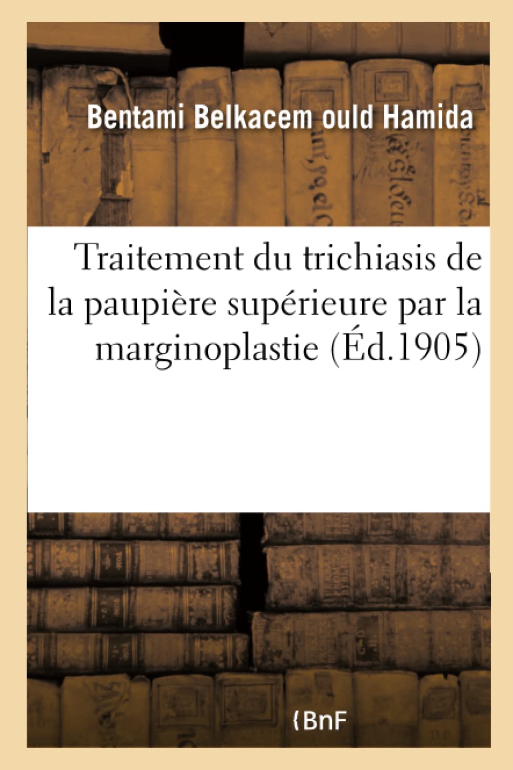 Traitement du trichiasis de la paupière supérieure par la marginoplastie book