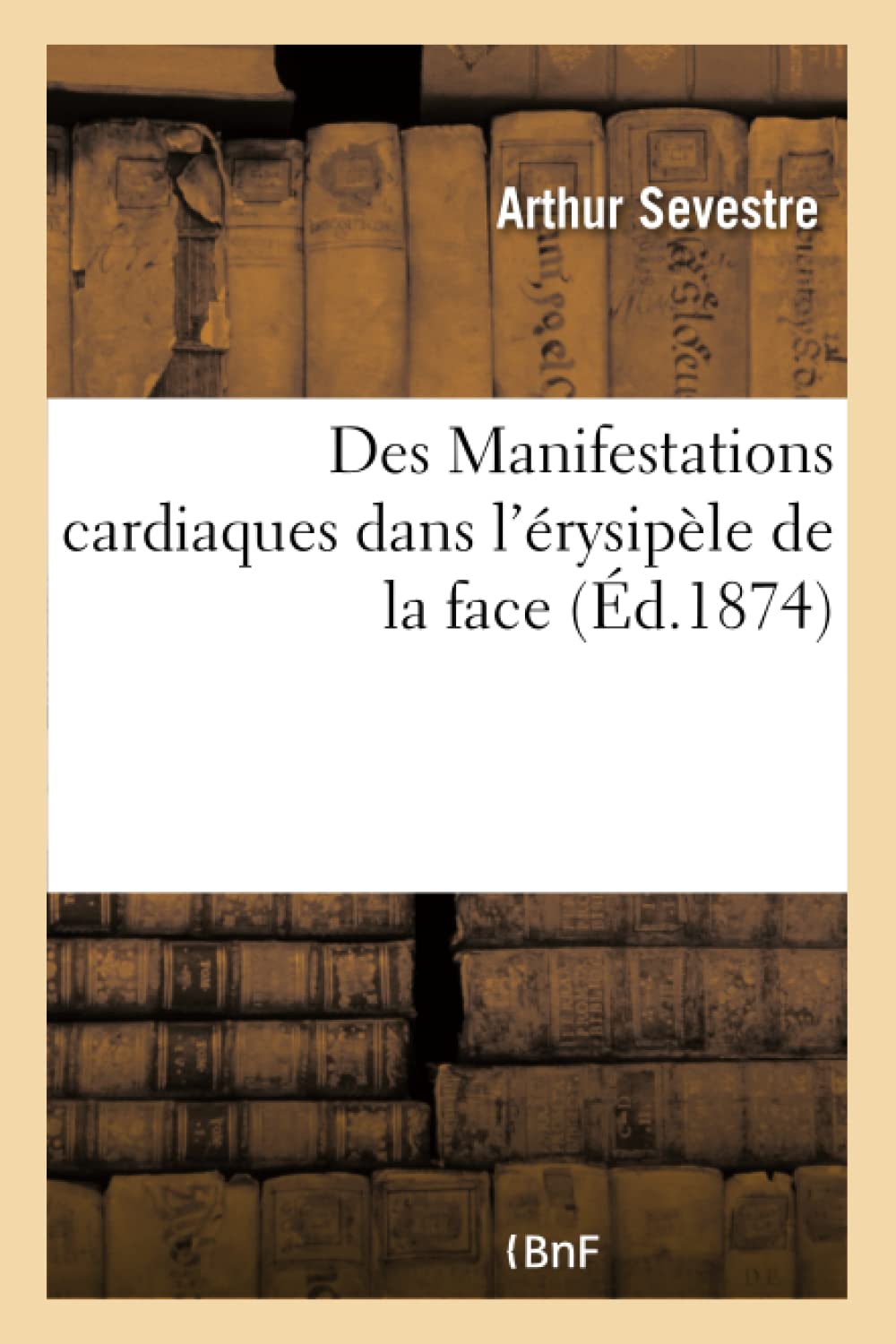 Des Manifestations cardiaques dans l'érysipèle de la face book