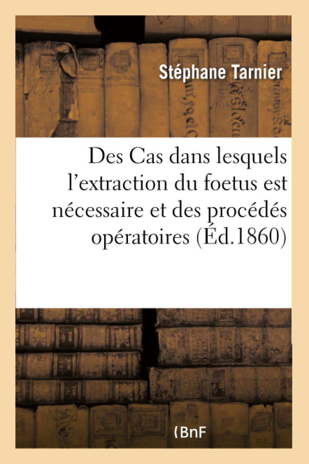 Des Cas dans lesquels l'extraction du foetus est nécessaire et des procédés opératoires book