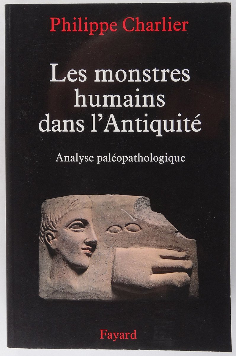 Les monstres humains dans l'Antiquité: Analyse paléopathologique book